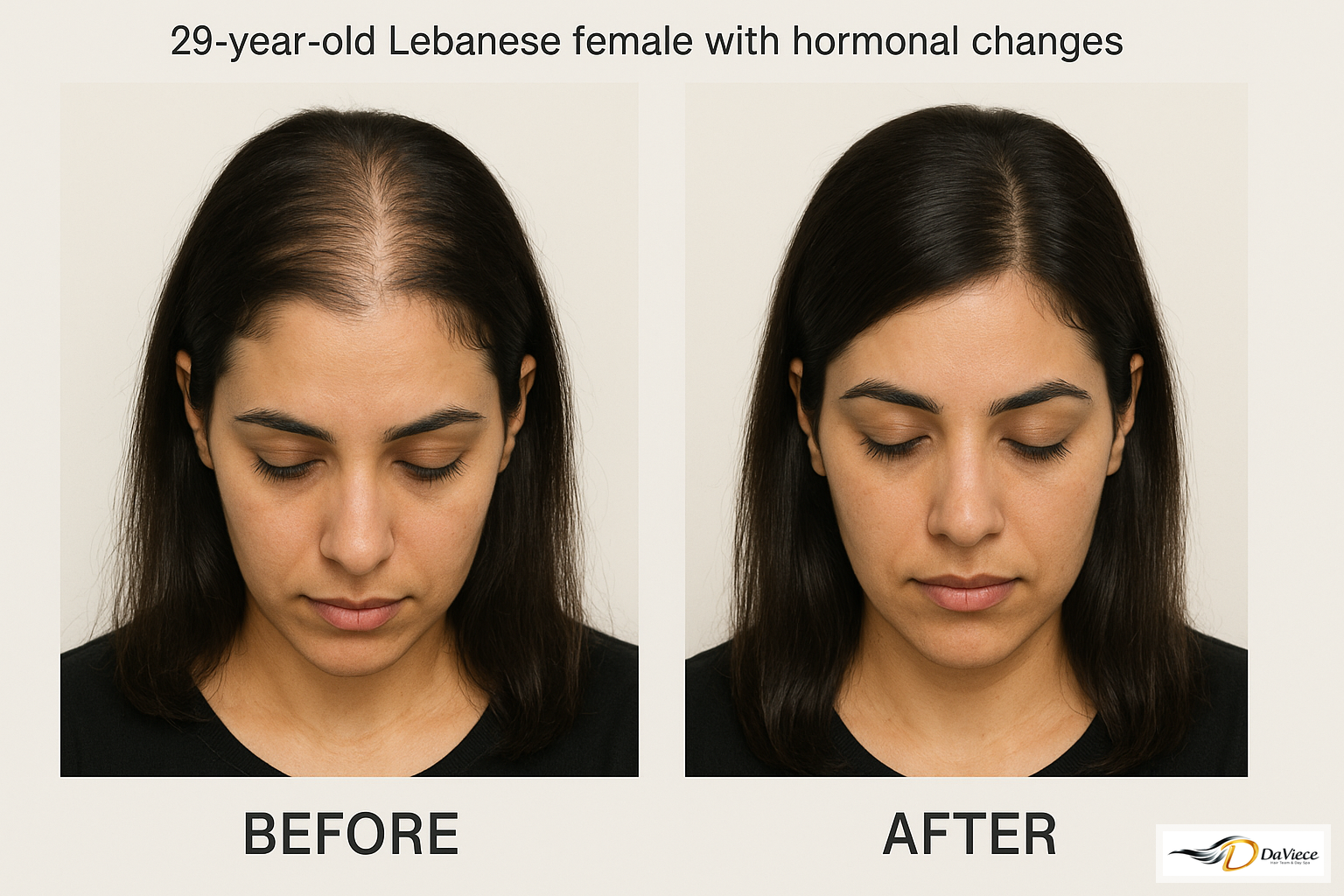 Hair transformation - Before and After